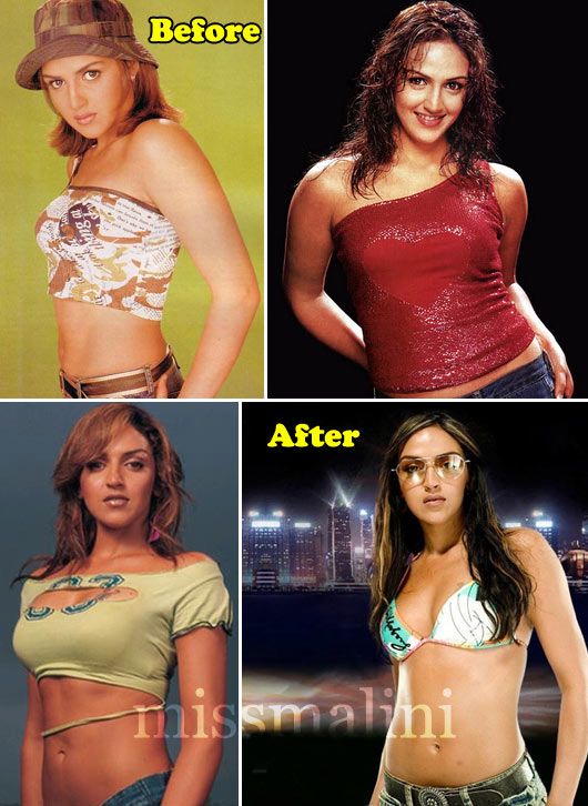 Esha Deol- Before & After