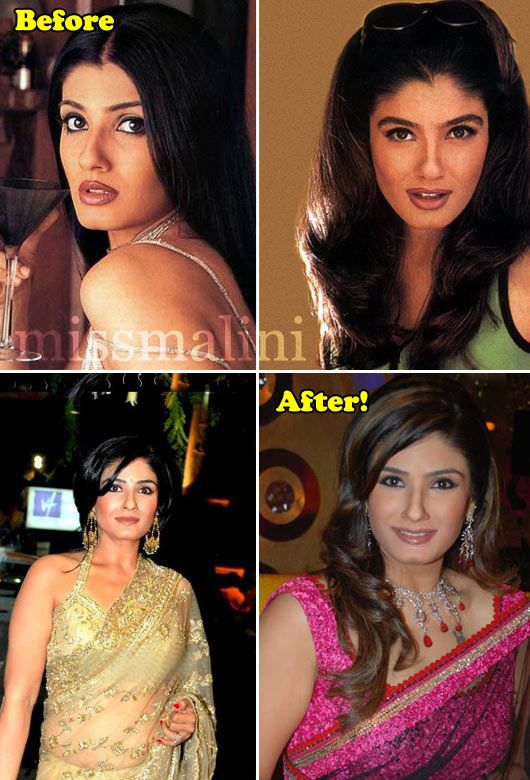 Raveena Tandon: Before & After