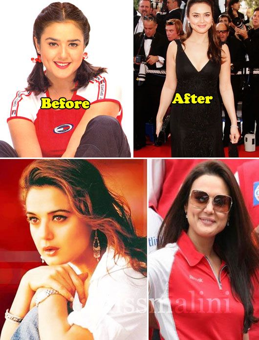 Preity Zinta: Before & After