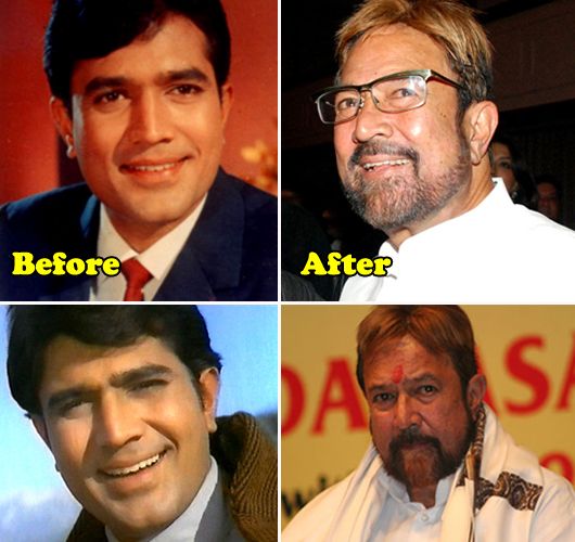 Rajesh Khanna: Before & After