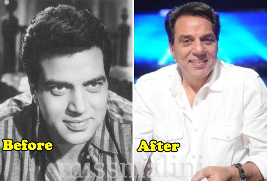 Dharmendra: Before & After