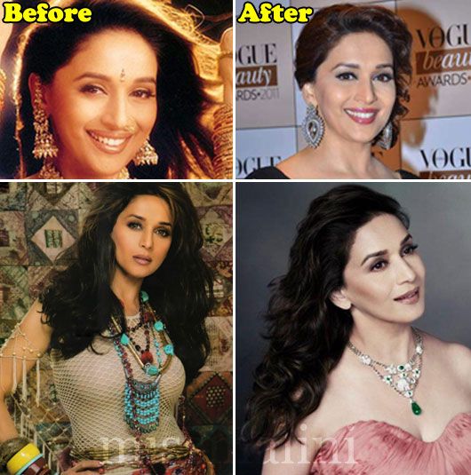 Madhuri Dixit: Before & After