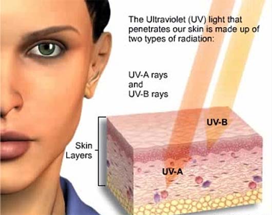 Ultraviolet (UV) Radiation (Photo Courtesy | www.fda.gov )