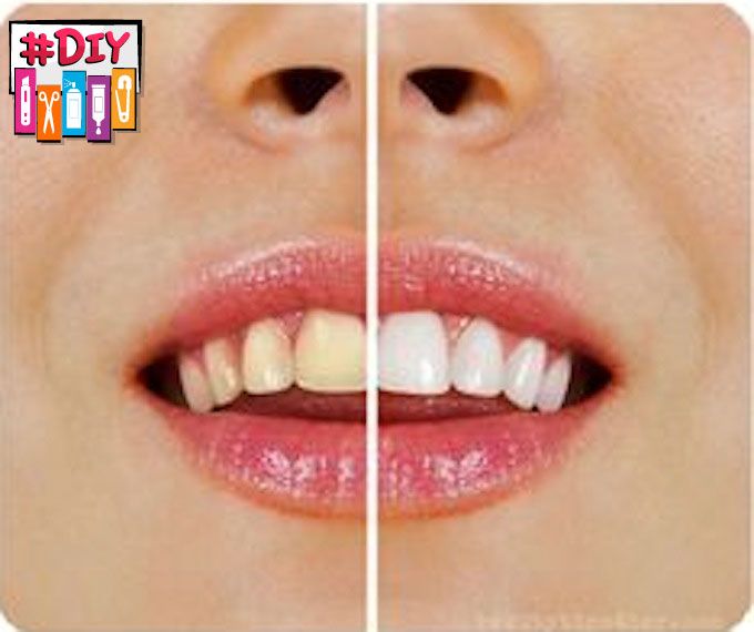 DIY Tooth Whitener