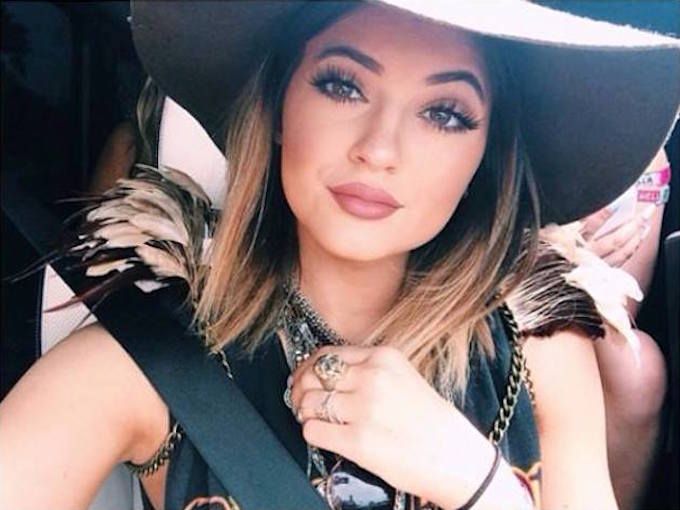 This Just In: Kylie Jenner Admits To Having Lip Fillers!