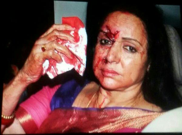 Hema Malini meets with an accident | Source: Twitter |