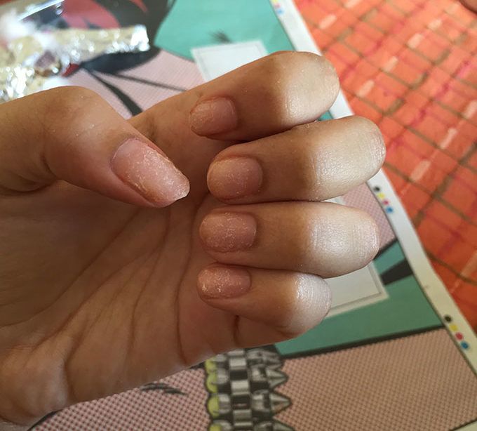 Here's What The White Mark On Your Nail Really Means | MissMalini