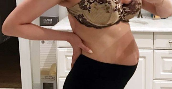 This Model Showed Off Her Post-Pregnancy Stomach To Make An Important Point