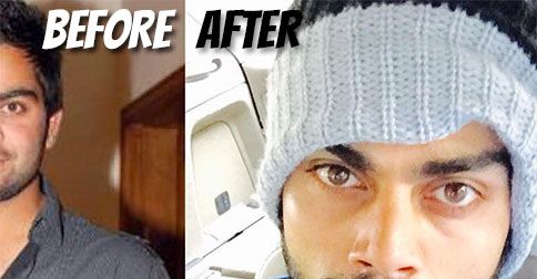 Wow! Virat Kohli Just Shared This Before &#038; After Photo Of His Chubby Days