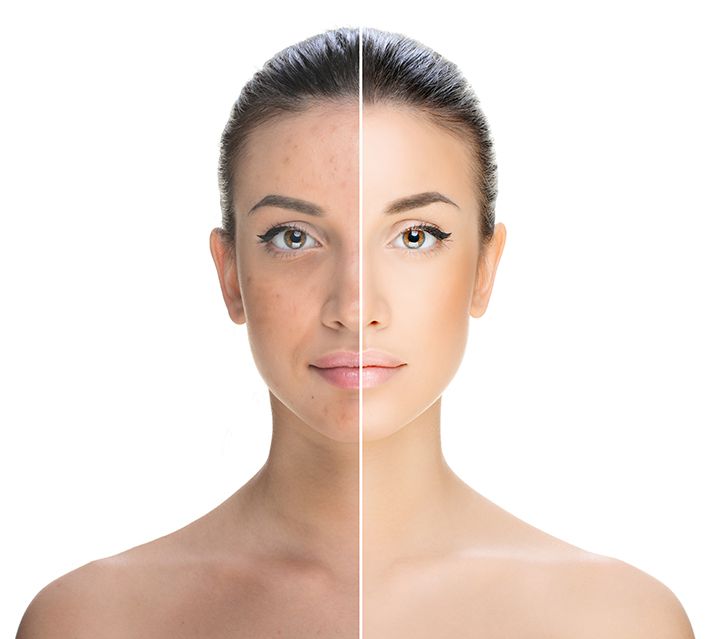 How To Deal With Uneven Skin Tone
