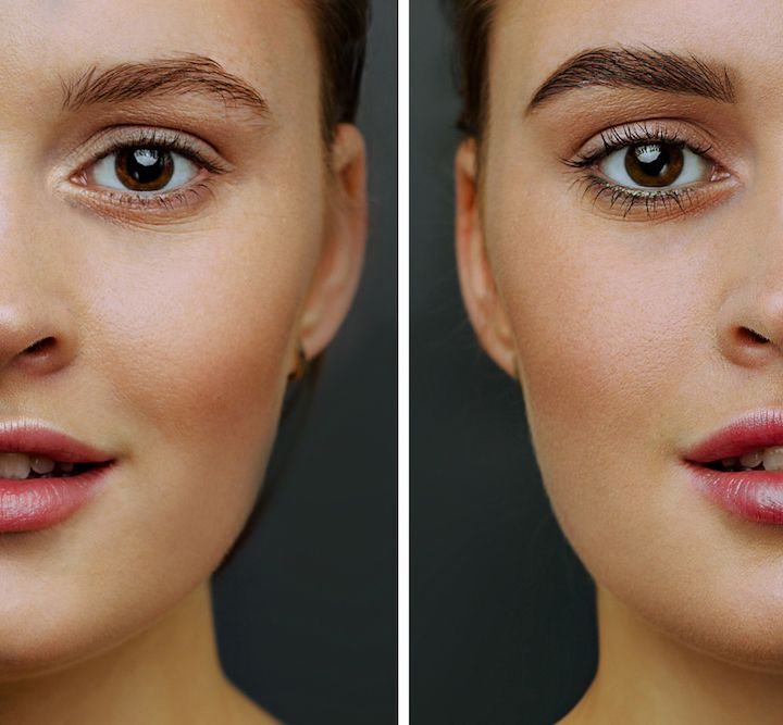 20 Brow Before &#038; Afters That Will Blow Your Mind