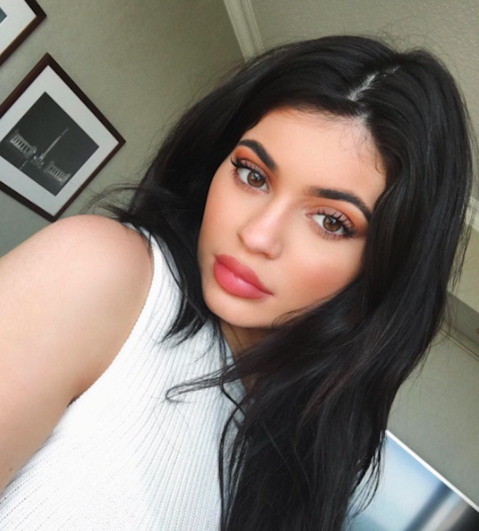 Kylie Jenner Is Going Back To Her Original Lips & We’re All For It