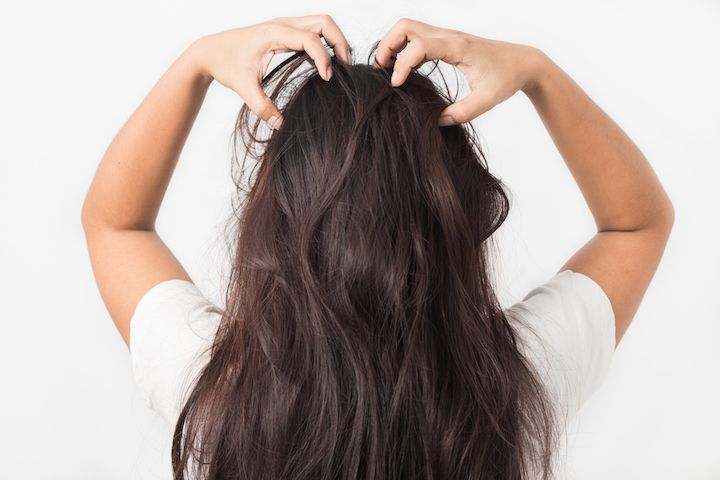 6 Ways To Solve Your Dandruff Problems Once And For All