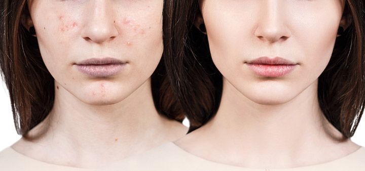 Skin (Image Courtesy: Shutterstock)