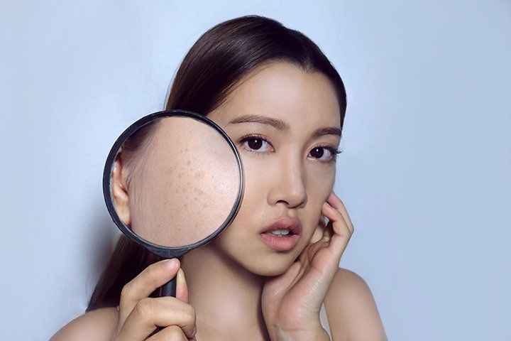 Woman Using Magnifying Glass On Skin By FlyingFlokerr | Source: Shutterstock