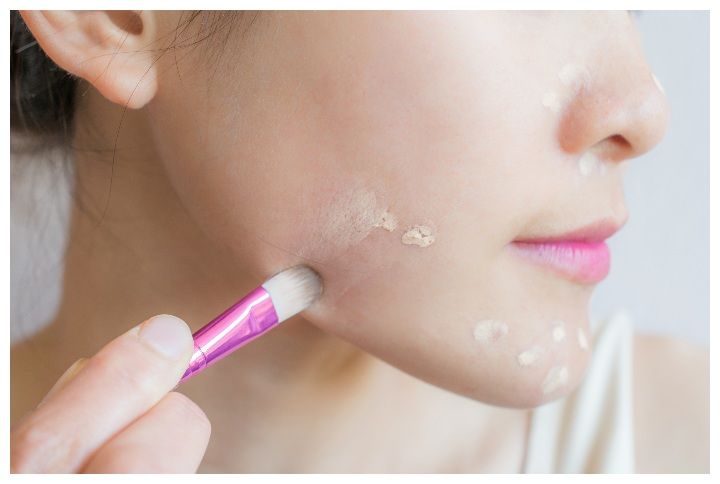 The Only 3 Makeup Products You’ll Need To Conceal A Pimple