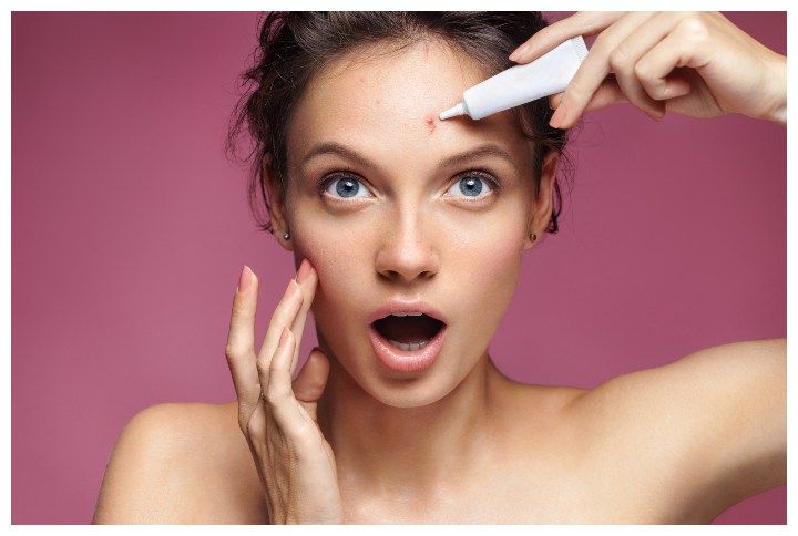 Girl Looking At A Pimple In Shock by Romariolen | www.shutterstock.com