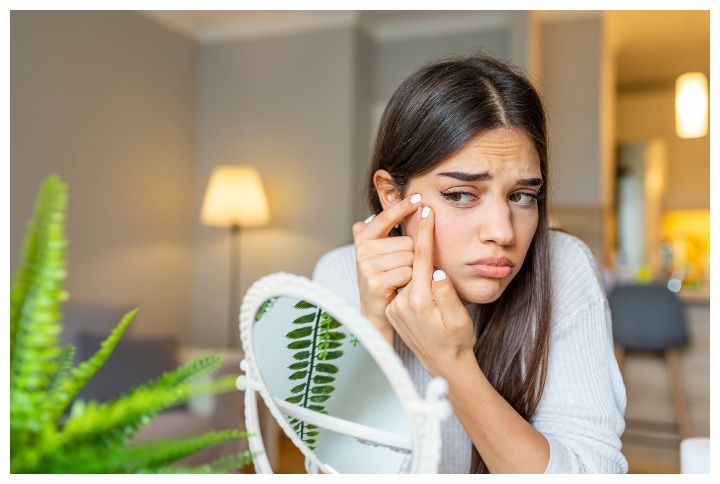 3 Things That Happen To Your Skin When You Pop Pimples