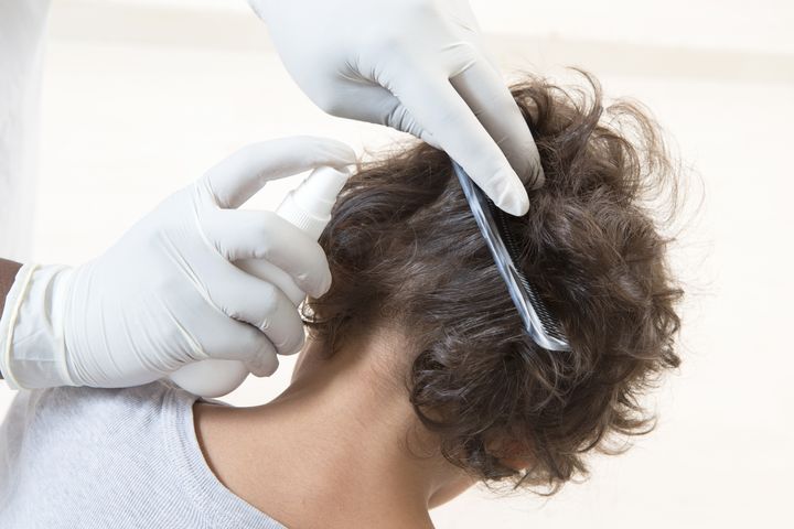 Head lice treatment. By JPC-PROD | www.shutterstock.com
