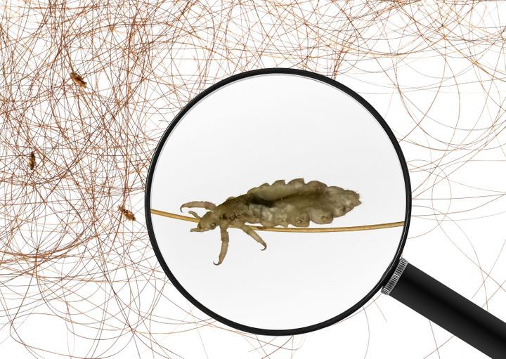 View through a magnifying glass and human hair with head lice. By Protasov AN | www.shutterstock.com