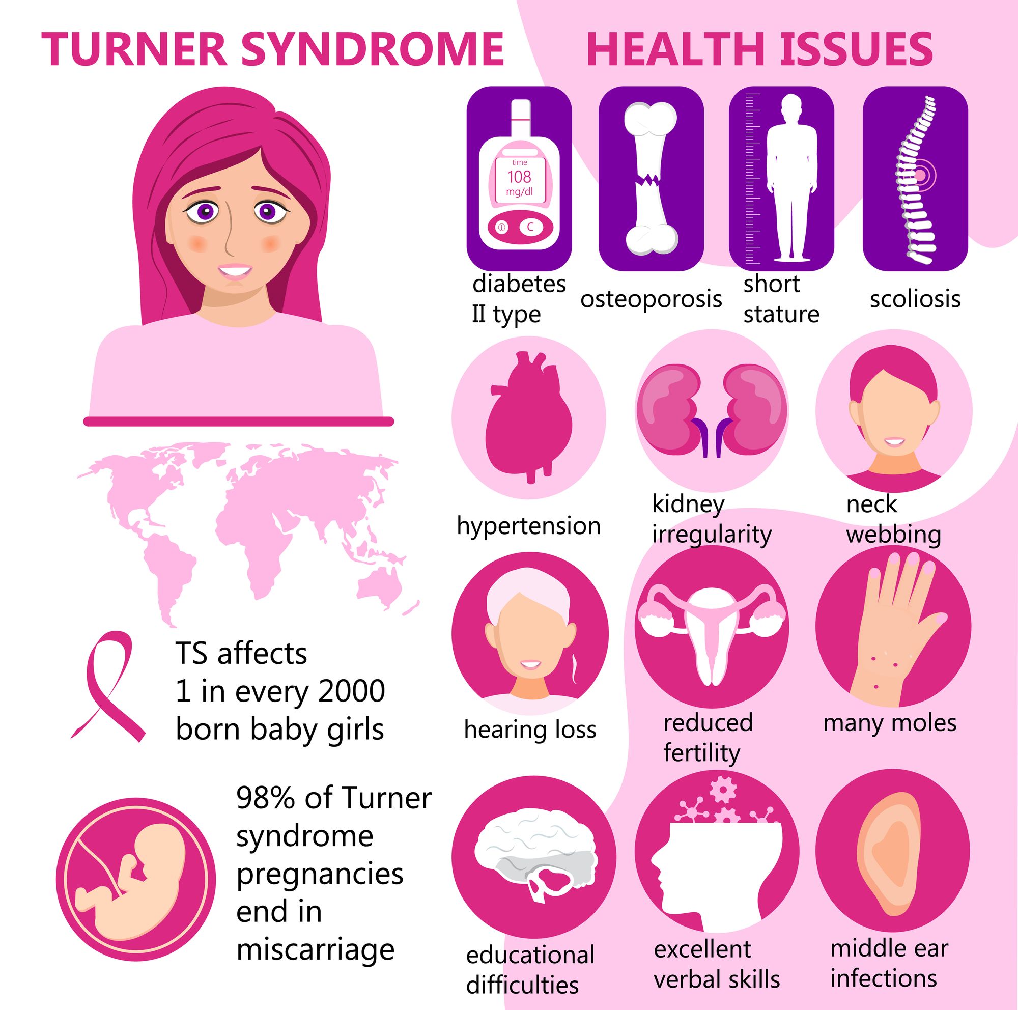 Turner Syndrome by 777 Bond vector | www.shutterstock.com