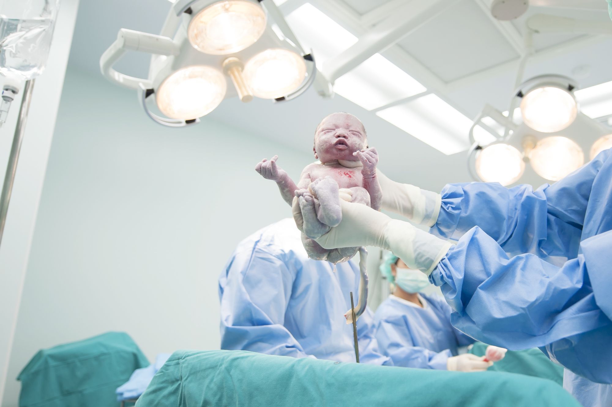 Medical Team Performing A C-Section by SweetLeMontea | www.shutterstock.com