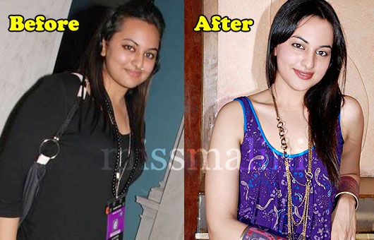 Sonakshi Sinha Before and After the Weight Loss